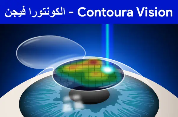 Contoura-Vision---كونتورا-فيجن