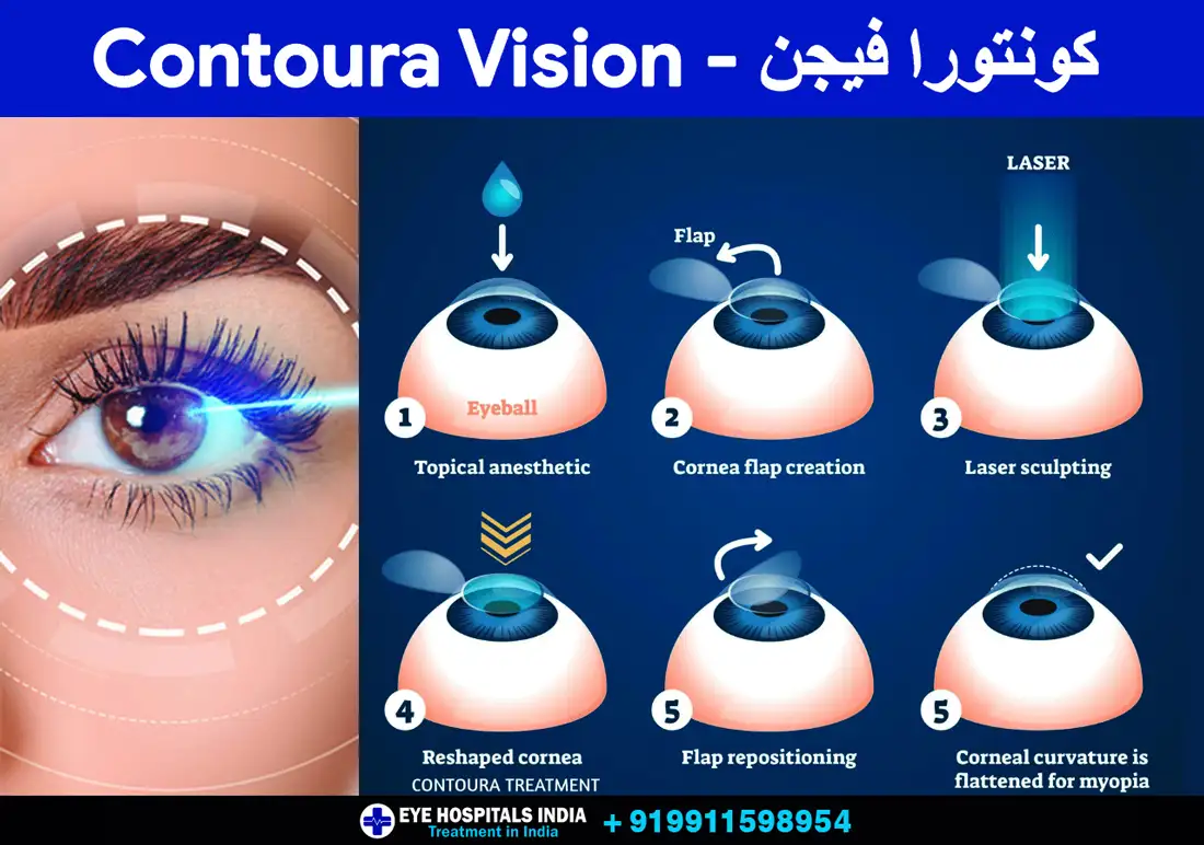 Contoura-Vision.-كونتورا-فيجن