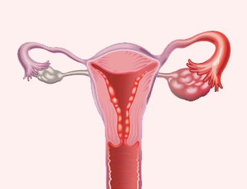 Fertility-treatment-and-IVF-Treatments,-India