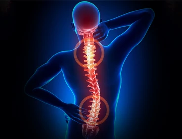 Treatment-of-spinal-diseases,-India