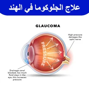 علاج-الجلوكوما-في-الهند