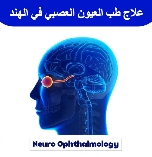 علاج-طب-العيون-العصبي-في-الهند
