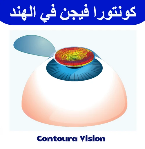 كونتورا فيجن في الهند